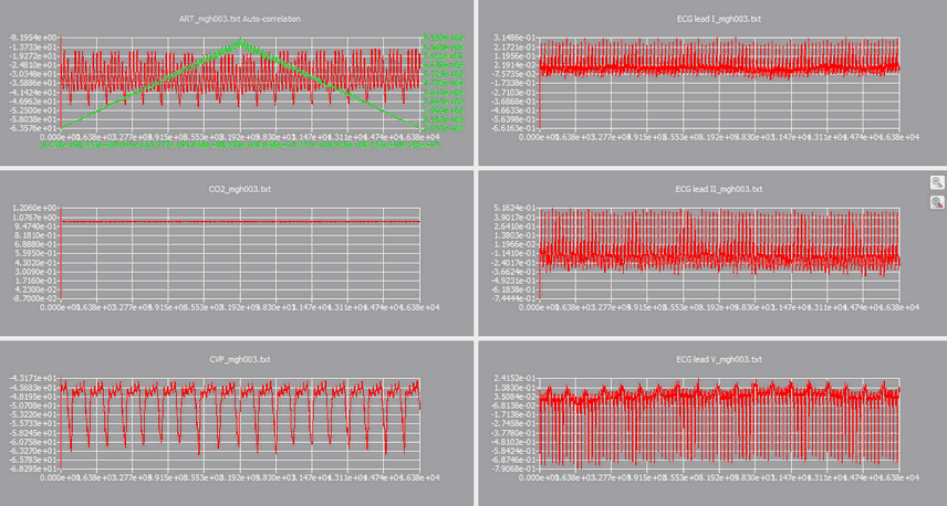 hm_example_autocorrelation.zoom67