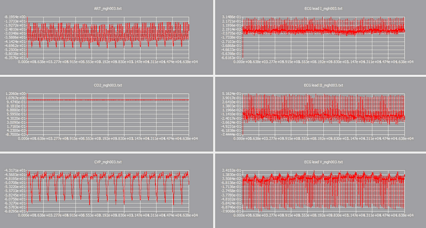 hm_example_conjunct_1.zoom67