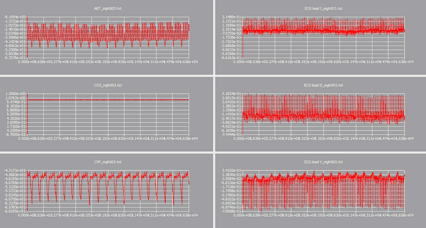 conjunct_1.zoom68