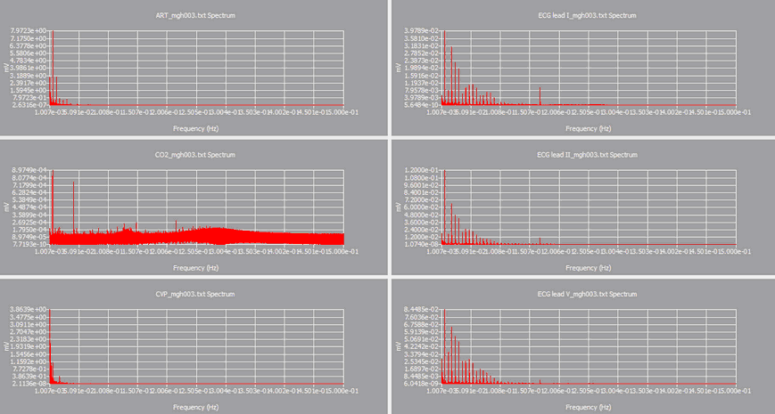 hm_example_frequencydomain_fft.zoom68