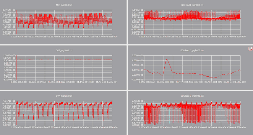 hm_example_pattern_buildpattern.zoom67