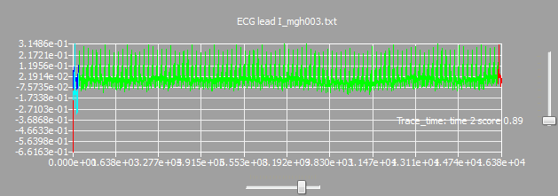 hm_example_pattern_tracebytime