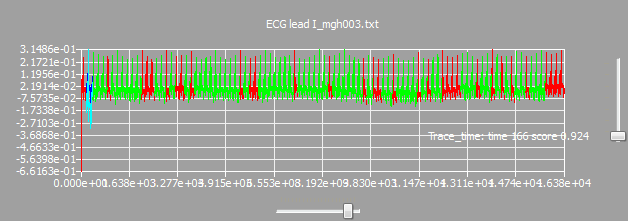 hm_example_pattern_tracebytime_2