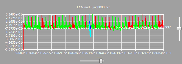 hm_example_pattern_tracebytime_3